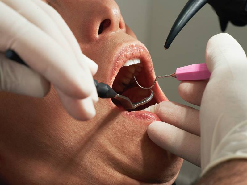 Retraite du dentiste: pourquoi souscrire à un contrat complémentaire retraite? 